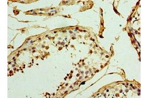 Immunohistochemistry of paraffin-embedded human testis tissue using ABIN7159831 at dilution of 1:100 (UCP1 antibody  (AA 1-307))