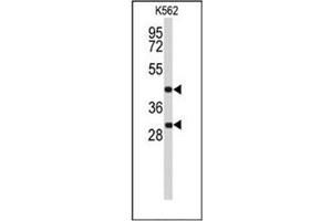 Western blot analysis of DFFA / ICAD Antibody (C-term) in K562 cell line lysates (35ug/lane). (DFFA antibody  (C-Term))