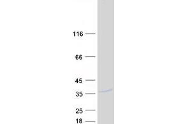 DSCR3 Protein (Myc-DYKDDDDK Tag)