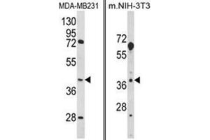 (LEFT) Western blot analysis of HOMER3 Antibody (Center) in MDA-MB231 cell line lysates (35ug/lane).
