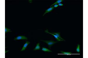 Immunofluorescence of purified MaxPab antibody to RIOK2 on HeLa cell.