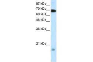 Western Blotting (WB) image for anti-Tripartite Motif Containing 32 (TRIM32) antibody (ABIN2460275) (TRIM32 antibody)