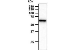 The HepG2 cell lysate (40ug) were resolved by SDS-PAGE, transferred to PVDF membrane and probed with anti-human ACSF2 antibody (1:1000). (ACSF2 antibody)