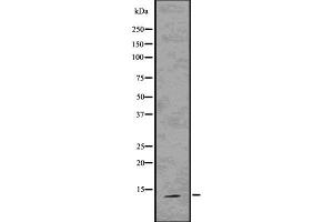 Western blot analysis S100A9 using 293 whole cell lysates (S100A9 antibody)