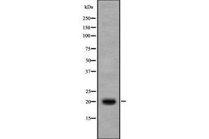 Western blot analysis IL17B using Jurkat whole cell lysates (IL17B antibody  (Internal Region))