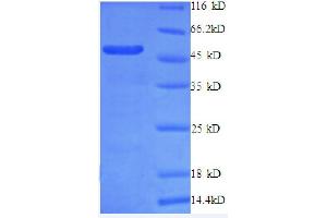 SDS-PAGE (SDS) image for Ribosomal Protein L10a (RPL10A) (AA 4-215), (partial) protein (GST tag) (ABIN1046445) (RPL10A Protein (AA 4-215, partial) (GST tag))