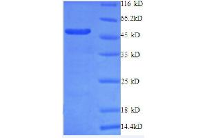 SDS-PAGE (SDS) image for Ribosomal Protein L10a (RPL10A) (AA 4-215), (partial) protein (GST tag) (ABIN1046445)