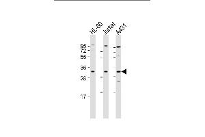 All lanes : Anti-CASP3 Antibody (Center) at 1:2000 dilution Lane 1: HL-60 whole cell lysate Lane 2: Jurkat whole cell lysate Lane 3: A431 whole cell lysate Lysates/proteins at 20 μg per lane. (Caspase 3 antibody  (AA 60-90))