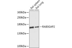 Western blot analysis of extracts of various cell lines, using RG antibody (ABIN7269806) at 1:1000 dilution. (RAB3GAP2 antibody  (AA 1-200))