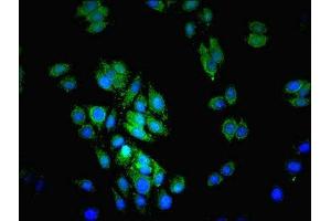 Immunofluorescent analysis of HepG2 cells using ABIN7158764 at dilution of 1:100 and Alexa Fluor 489-congugated AffiniPure Goat Anti-Rabbit IgG(H+L) (Lipase A antibody  (AA 22-399))