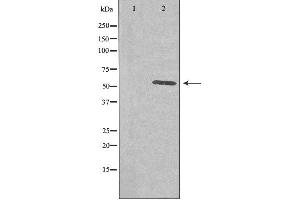 Western blot analysis of extracts from COLO cells using PLK5 antibody. (PLK5 antibody  (Internal Region))