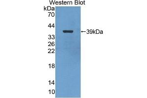 Detection of Recombinant NFkB2, Chicken using Polyclonal Antibody to Nuclear Factor Kappa B2 (NFkB2) (Nuclear Factor kappa B2 (AA 37-342) antibody)