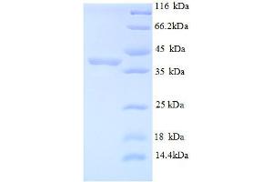 MIB1 (AA 5-332), (partial) protein (His tag)