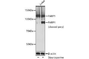 Western blot analysis of extracts of Jurkat cells, using P antibody  at 1:1000 dilution. (PARP1 antibody)