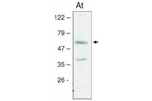 Western blot analysis of Arabidopsis chloroplast proteins with anti-STN8 kinase