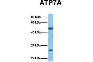 Host:  Rabbit  Target Name:  ATP7A  Sample Tissue:  Human Ovary Tumor  Antibody Dilution:  1. (ATP7A antibody  (N-Term))