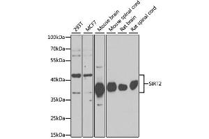 Western blot analysis of extracts of various cell lines, using SIRT2 antibody (ABIN6291363) at 1:1000 dilution.