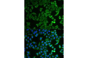 Immunofluorescence analysis of HeLa cell using NPRL2 antibody. (NPRL2 antibody)