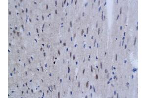 Formalin-fixed and paraffin embedded rat myocardium labeled with Anti-TNFAIP3 Polyclonal Antibody, Unconjugated (ABIN680938) at 1:200 followed by conjugation to the secondary antibody and DAB staining (TNFAIP3 antibody  (AA 51-150))