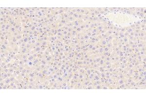 Detection of CD163 in Mouse Liver Tissue using Polyclonal Antibody to Cluster Of Differentiation (CD163) (CD163 antibody  (AA 697-972))
