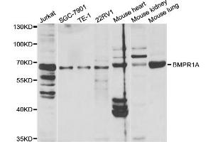Western blot analysis of extracts of various cell lines, using BMPR1A antibody. (BMPR1A antibody)
