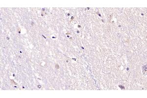Detection of NT3 in Human Cerebrum Tissue using Monoclonal Antibody to Neurotrophin 3 (NT3) (Neurotrophin 3 antibody  (AA 130-255))