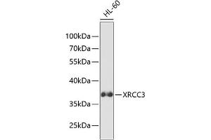 Western blot analysis of extracts of HL-60 cells, using XRCC3 antibody (ABIN3023005, ABIN3023006, ABIN3023007 and ABIN6219342) at 1:1000 dilution. (XRCC3 antibody  (AA 62-346))