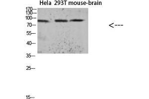 Western blot analysis of KB Hela lysate, antibody was diluted at 1:1000.