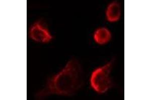 ABIN6278566 staining LOVO cells by IF/ICC. (EIF4E3 antibody  (Internal Region))