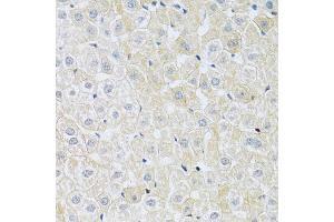 Immunohistochemistry of paraffin-embedded rat liver using SLC4A5 antibody (ABIN5998866) at dilution of 1/100 (40x lens).