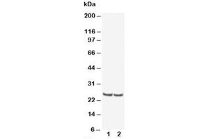 Western blot testing of TIMP4 antibody and Lane 1:  rat kidney (TIMP4 antibody  (AA 208-224))