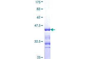 Image no. 1 for Adducin 3 (Gamma) (ADD3) (AA 462-560) protein (GST tag) (ABIN1305971) (ADD3 Protein (AA 462-560) (GST tag))
