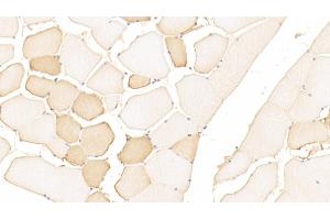 Detection of DMD in Human Skeletal muscle Tissue using Polyclonal Antibody to Dystrophin (DMD) (Dystrophin antibody  (AA 3048-3328))
