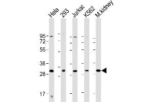 All lanes : Anti-HOXB4 Antibody (Center) at 1:2000 dilution Lane 1: Hela whole cell lysate Lane 2: 293 whole cell lysate Lane 3: Jurkat whole cell lysate Lane 4: K562 whole cell lysate Lane 5: mouse kidney lysate Lysates/proteins at 20 μg per lane. (HOXB4 antibody  (AA 138-171))
