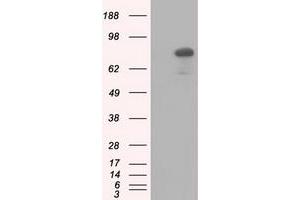 HEK293T cells were transfected with the pCMV6-ENTRY control (Left lane) or pCMV6-ENTRY C17orf28 (Right lane) cDNA for 48 hrs and lysed. (HID1/DMC1 antibody)