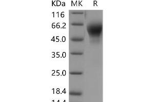 Western Blotting (WB) image for Interleukin 1 Receptor, Type II (IL1R2) (Active) protein (His tag) (ABIN7196346) (IL1R2 Protein (His tag))
