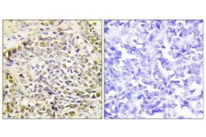 Immunohistochemistry (IHC) image for anti-Iroquois Homeobox Protein 2 (IRX2) (Internal Region) antibody (ABIN1849950) (IRX2 antibody  (Internal Region))