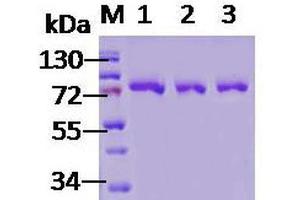 SDS-PAGE of 78 kDa native human Grp78 protein (ABIN1686699, ABIN1686700 and ABIN1686701).
