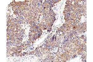 IHC analysis of RPL8 using anti-RPL8 antibody (ABIN7601179). (RPL8 antibody  (AA 3-257))