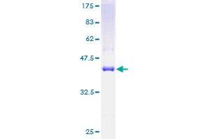 TRAPPC2 Protein (AA 1-140) (GST tag)