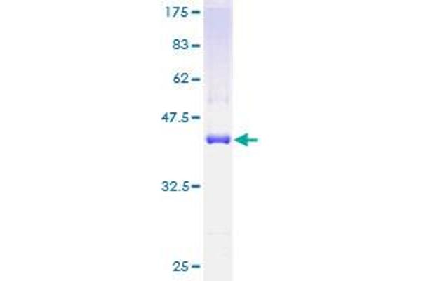 TRAPPC2 Protein (AA 1-140) (GST tag)
