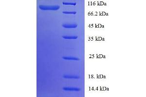 SDS-PAGE (SDS) image for P450 (Cytochrome) Oxidoreductase (POR) (AA 2-671), (partial) protein (GST tag) (ABIN5710131)
