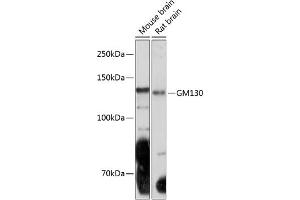 Western blot analysis of extracts of various cell lines, using GM130 Rabbit mAb (ABIN7267494) at 1:1000 dilution. (Golgin A2 (GOLGA2) antibody)