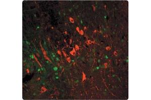 Immunofluorescence (IF) image for anti-Tyrosine Hydroxylase (TH) antibody (ABIN955409)