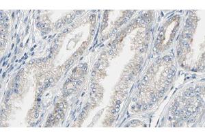 ABIN6269321 at 1/100 staining Human prostate tissue by IHC-P. (Dynamin 1 antibody  (C-Term))