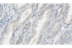 ABIN6269321 at 1/100 staining Human prostate tissue by IHC-P. (Dynamin 1 antibody  (C-Term))