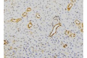 ABIN6279732 at 1/100 staining Mouse kidney tissue by IHC-P. (RAB23 antibody  (C-Term))