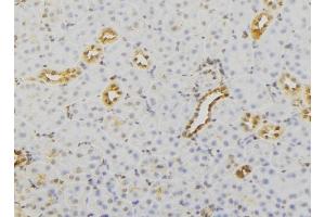 ABIN6279732 at 1/100 staining Mouse kidney tissue by IHC-P. (RAB23 antibody  (C-Term))