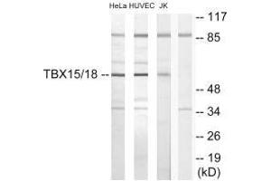 Western blot analysis of extracts from HeLa cells, HUVEC cells and Jurkat cells, using TBX15/18 antibody. (Tbx15 + Tbx18 antibody)
