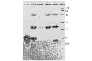 Western Blotting (WB) image for anti-Human Papilloma Virus 18 E7 (HPV-18 E7) (AA 36-70) antibody (ABIN781778) (HPV18 E7 antibody  (AA 36-70))
